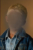 An photograph of a boy, but the central area of vision is darkened and blurred, making it almost impossible to see the boy's face